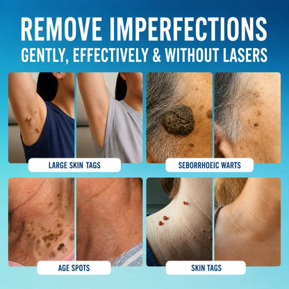Anti-Skin Tag Roller