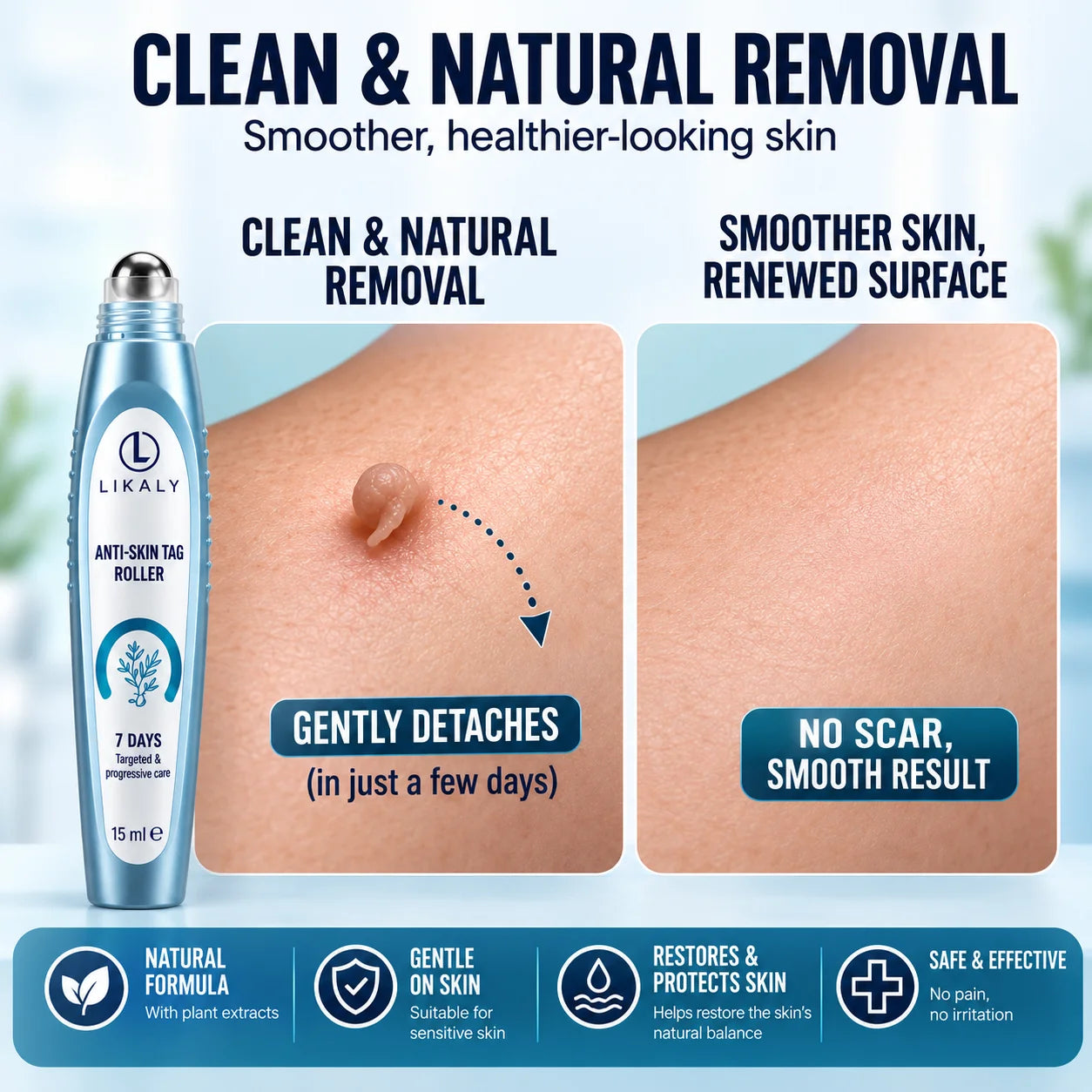Anti-Skin Tag Roller