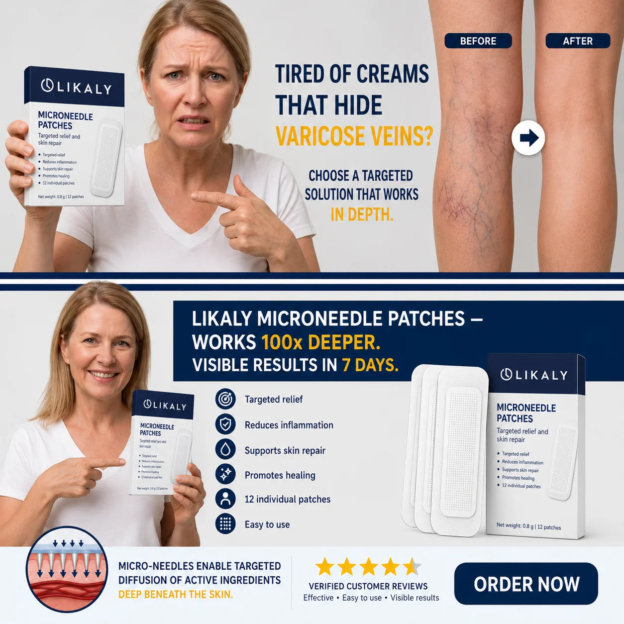 Patch Anti-Varicose Veins