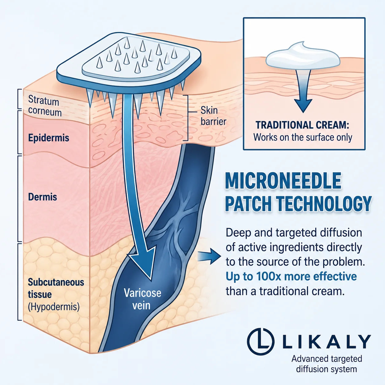 Patch Anti-Varicose Veins