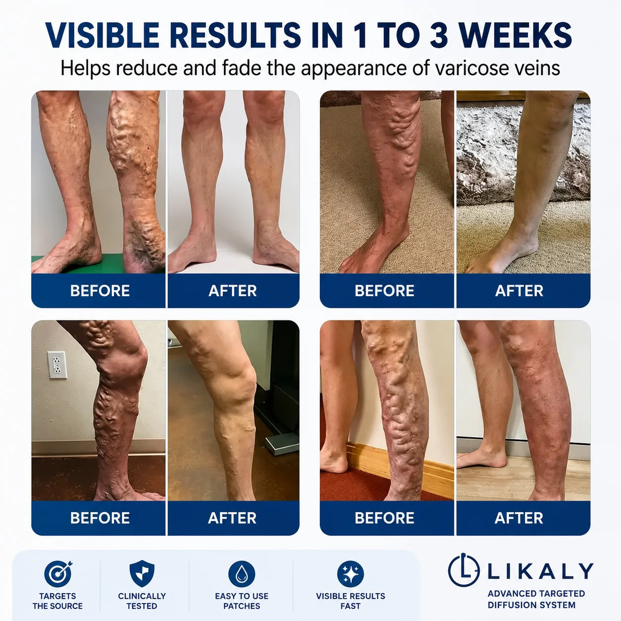 Patch Anti-Varicose Veins